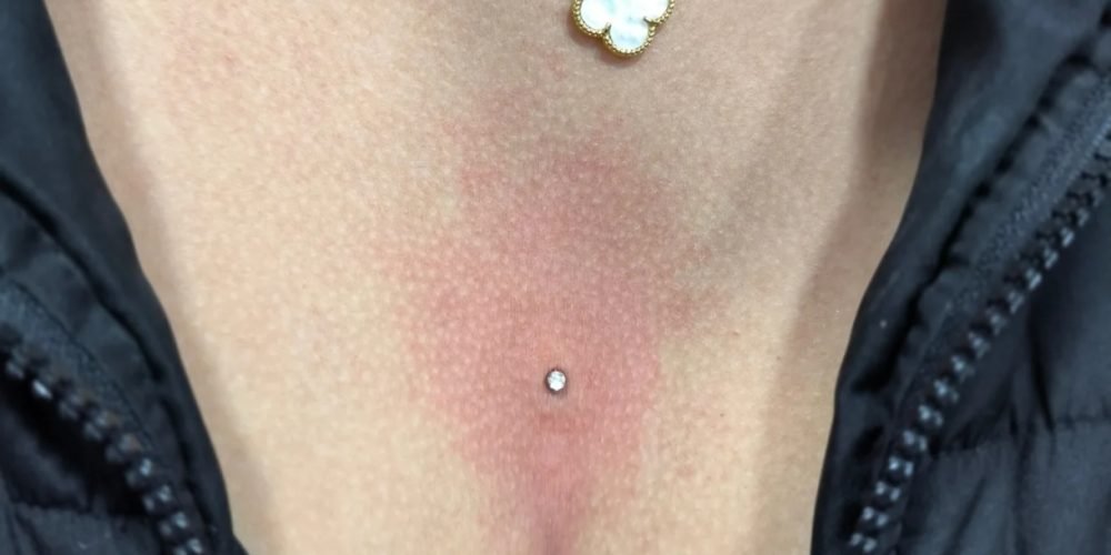 MICRODERMAL EM SANTA ISABEL - BODY PIERCER RENAN REA